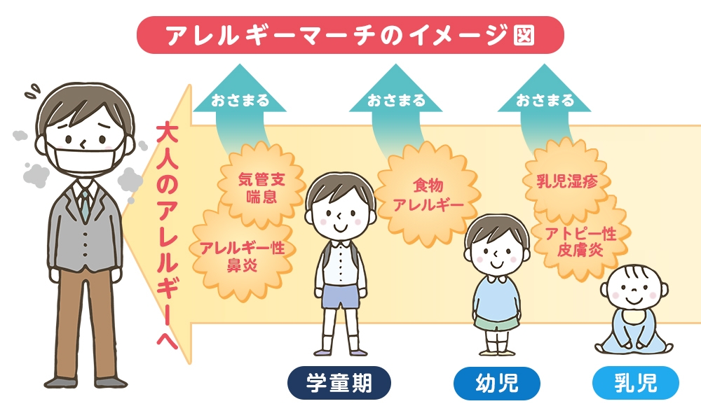 アレルギーマーチ