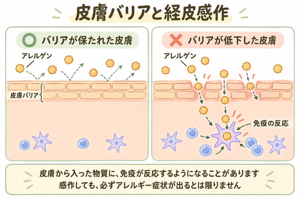 バリア機能が保たれた皮膚と、湿疹によってバリア機能が低下しアレルゲンが入りやすくなった皮膚の比較図。