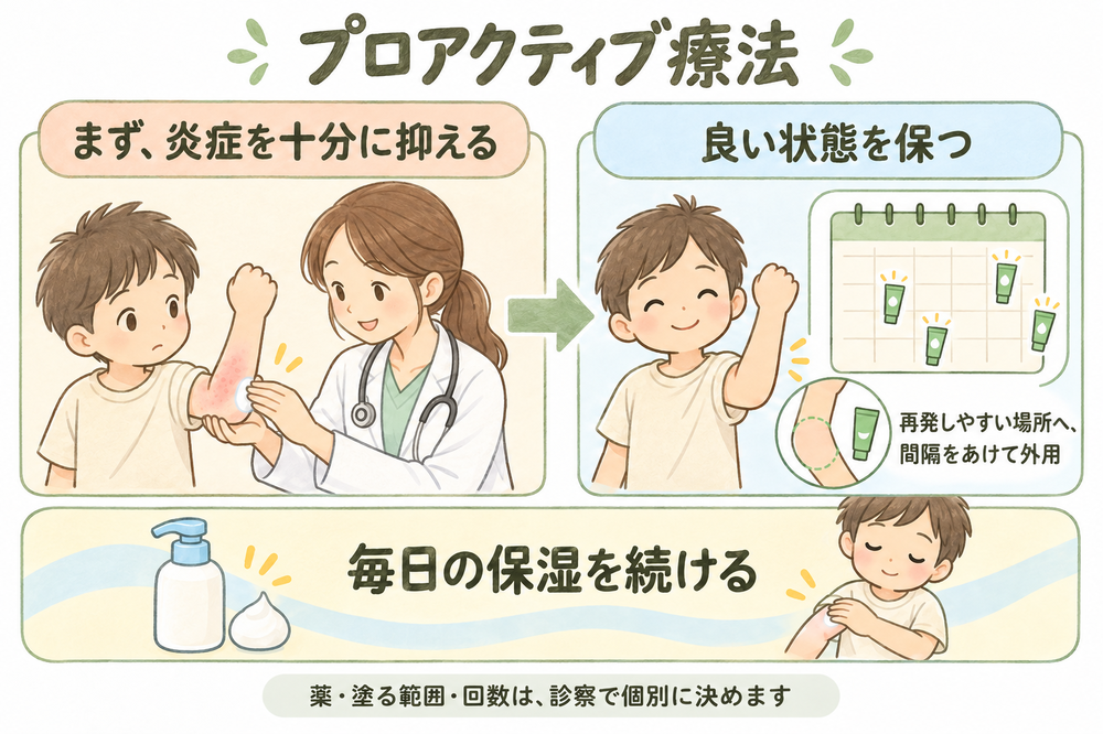 炎症を十分に抑えた後も保湿を続け、医師の指示で抗炎症薬を間欠的に使うプロアクティブ療法の流れ。