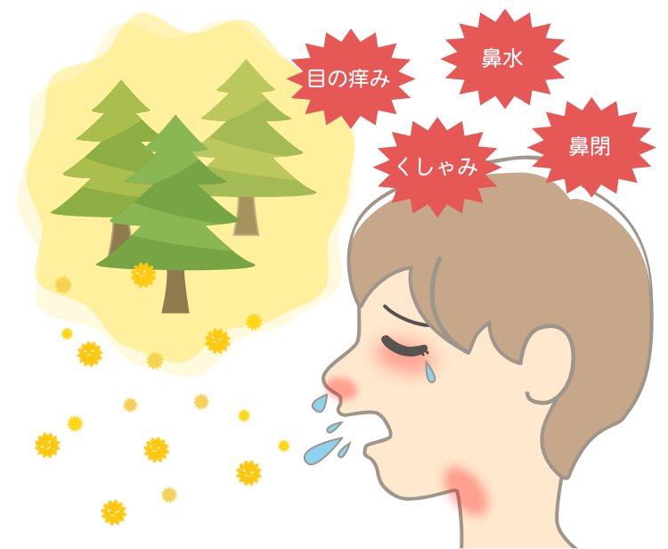 小児のスギ花粉症