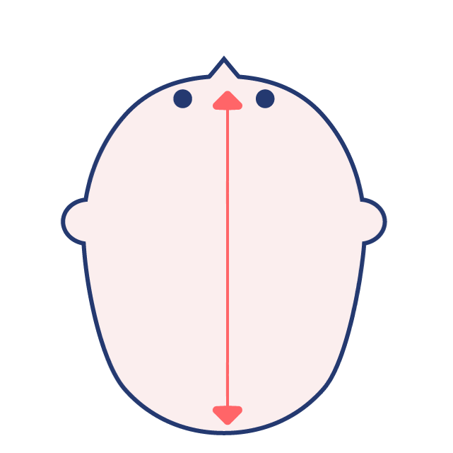 長頭症 長頭症
