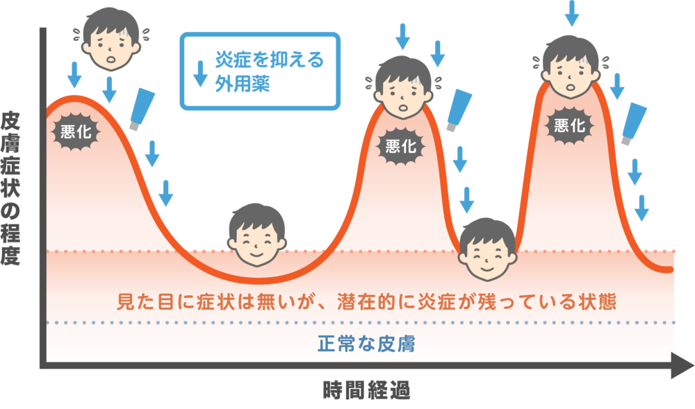 ステロイド外用薬での治療