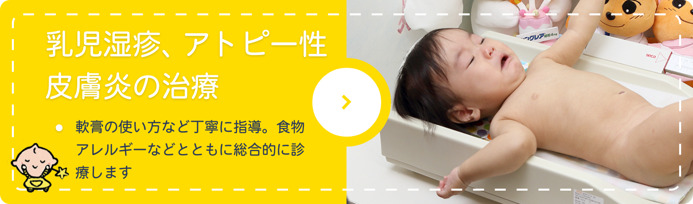 乳児湿疹、アトピー性
